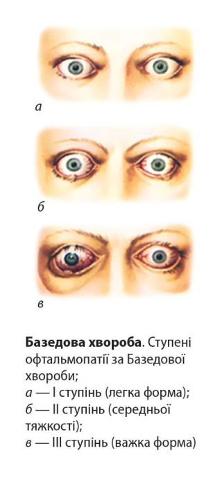 Базедоба х-ба3.jpg