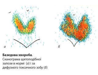 Базедоба х-ба4.jpg