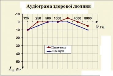 Аудіограма.jpg
